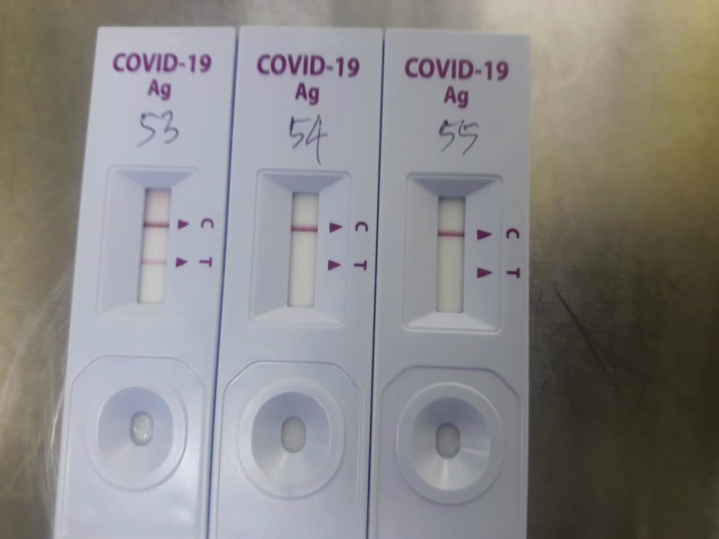 ПЦР против тестирования антигена: какой тест Covid-19 подходит для меня?